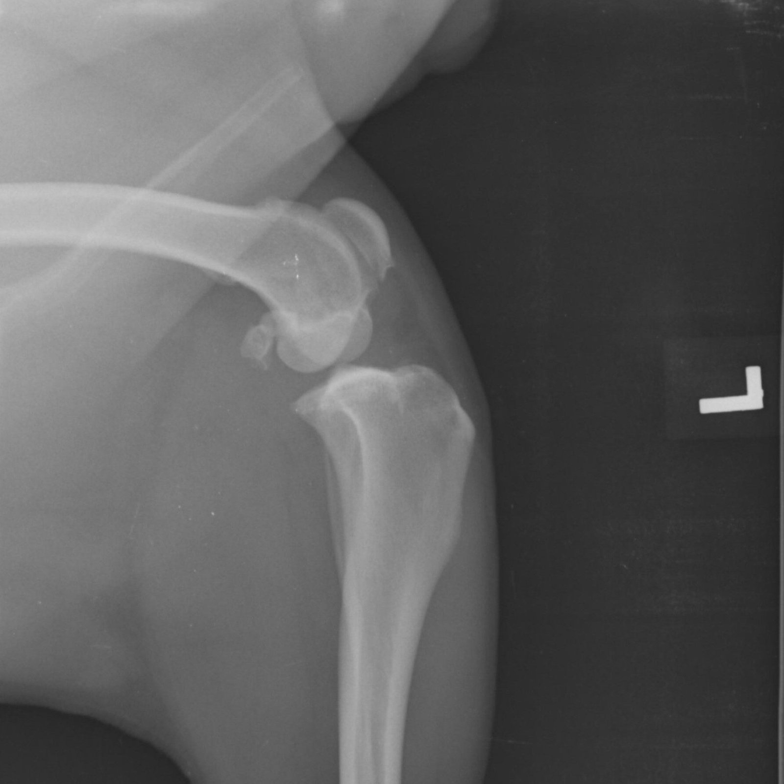 Radiografía de la rodilla de Lucas antes de la cirugía, con signos de rotura del ligamento cruzado craneal
